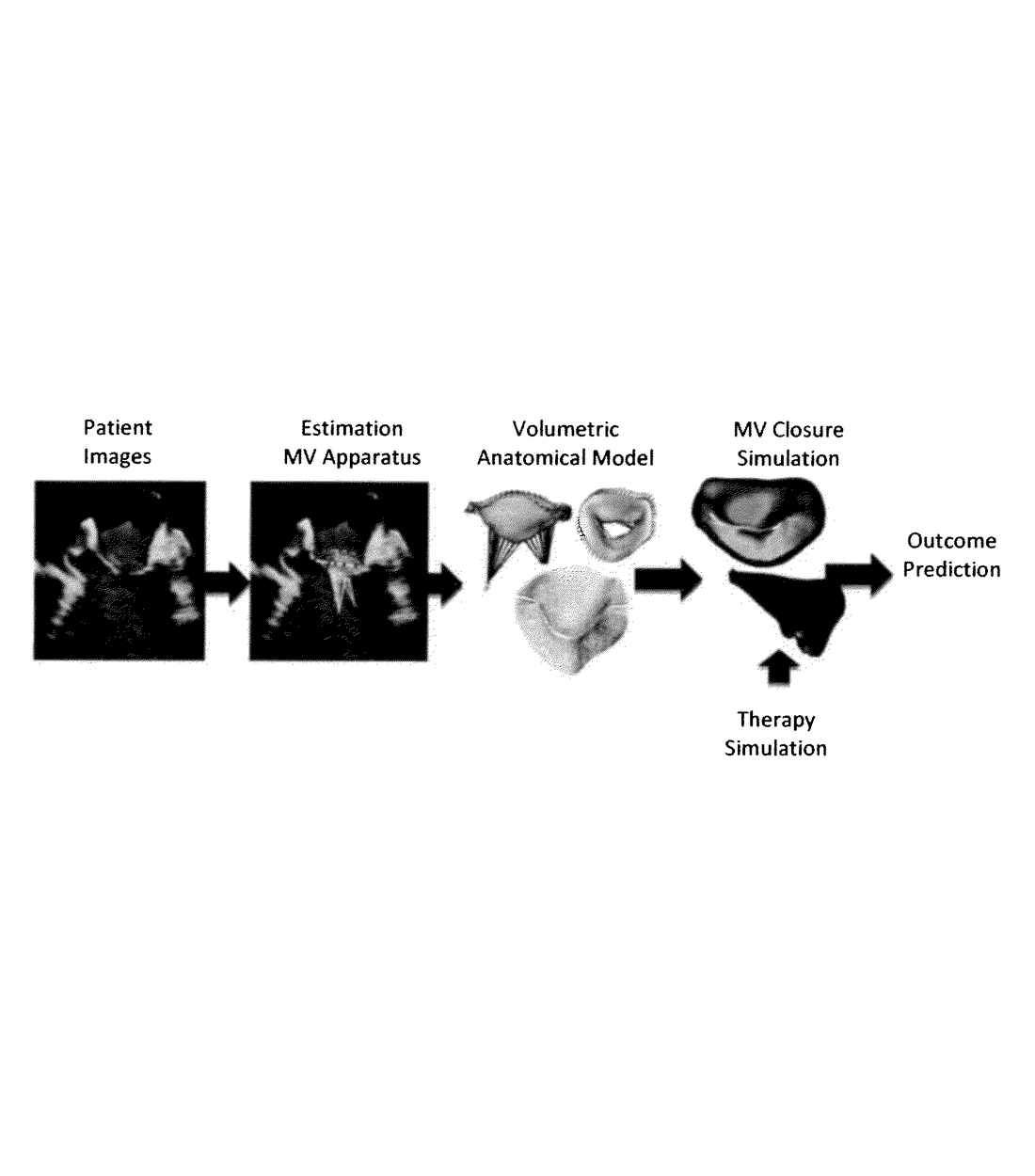 US8920322B2 — Valve treatment simulation from medical diagnostic imaging data