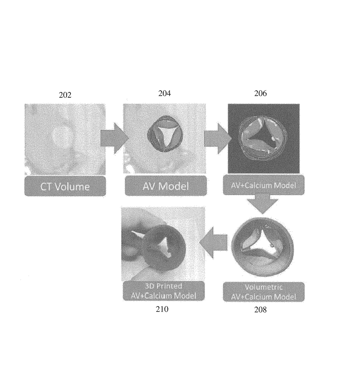 US9931790B2 — Method and system for advanced transcatheter aortic valve implantation planning